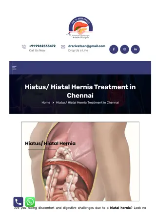 Hiatus Hiatal Hernia Treatment in Chennai - Dr. S. Srivatsan Gurumurthy