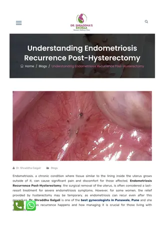 Endometriosis Recurrence Post-Hysterectomy