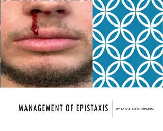 Comprehensive Guide to Epistaxis Management by Nurse Aliyu Ibrahim
