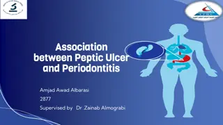 Association Between Peptic Ulcer and Periodontitis: Insights and Connections