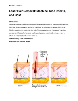 Laser Hair Removal_ Machine, Side Effects, and Cost