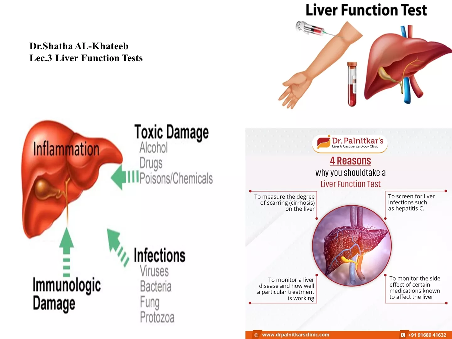 Liver Function Tests in Cholestatic Injury