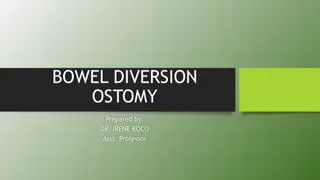 Bowel Diversion Ostomy: Definition, Classification, and Management