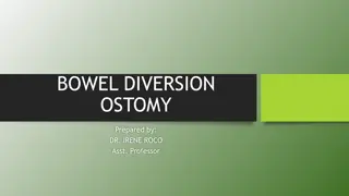 Understanding Bowel Diversion Ostomy: Definition, Classification, and Management
