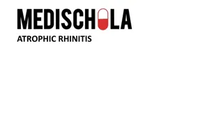 Understanding Atrophic Rhinitis: Causes, Symptoms, and Diagnosis