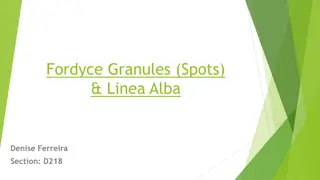 Fordyce Granules and Linea Alba in Oral Health