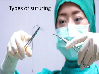 Types of Suturing Techniques and Applications