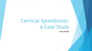 Cervical Spondylosis: Understanding Symptoms, Evaluation, and Treatment Options