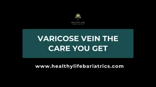 Varicose Vein The care you get- Healthy Life Bariatrics