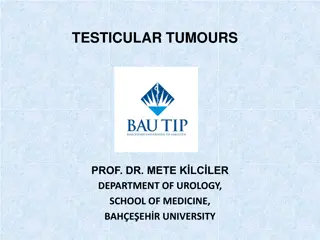 Testicular Tumors: Types, Classification, and Clinical Findings