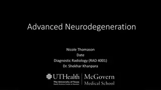 Advanced Neurodegeneration in a 50-Year-Old Female: A Diagnostic Radiology Case Study