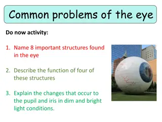 Common Eye Problems and Functionality