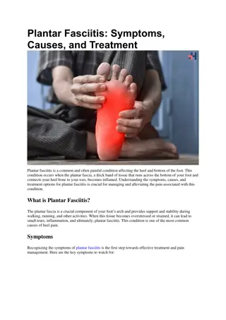 Plantar Fasciitis