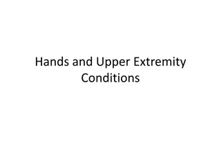 Overview of Hands and Upper Extremity Conditions
