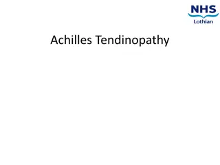 Understanding Achilles Tendinopathy: Causes, Symptoms, and Management