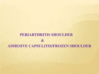 Understanding Frozen Shoulder and Adhesive Capsulitis