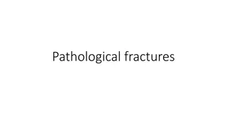 Fractures: Traumatic vs. Pathological and Modeling Options