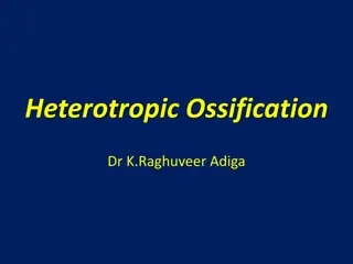 Overview of Heterotopic Ossification in Medical Science