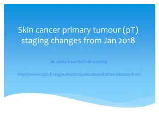 Skin Cancer Primary Tumour Staging Changes: RCPath Updates