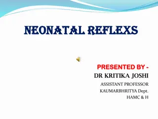 Neonatal Reflexes in Newborn Babies