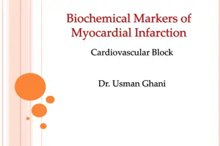 Understanding Biochemical Markers of Myocardial Infarction