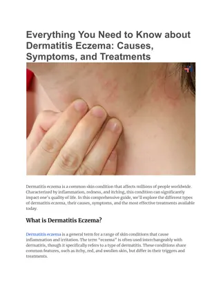 Everything You Need to Know about Dermatitis Eczema_ Causes, Symptoms