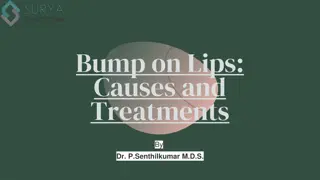 Bump on Lips - Surya Dental Care