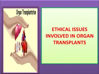 Ethical Issues in Organ Transplants