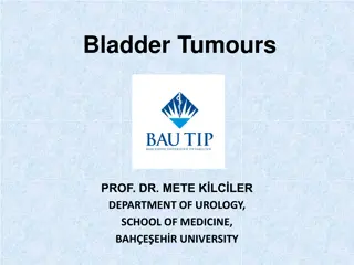 Overview of Bladder Tumours: Causes, Symptoms, and Diagnosis