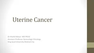 Understanding Uterine Cancer and Postmenopausal Bleeding