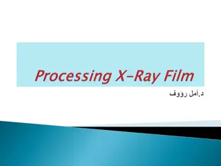 Understanding X-Ray Film Processing Techniques