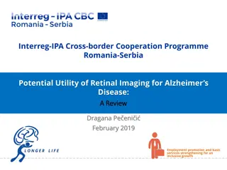 Retinal Imaging for Alzheimer's Disease: A Comprehensive Review