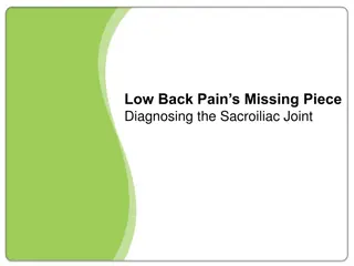 Sacroiliac Joint Dysfunction: A Comprehensive Guide