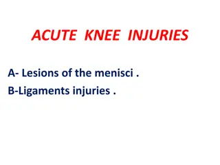 Acute Knee Injuries: Meniscal Tears and Ligament Injuries