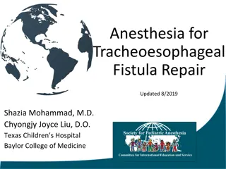 Anesthesia Considerations for Tracheoesophageal Fistula Repair