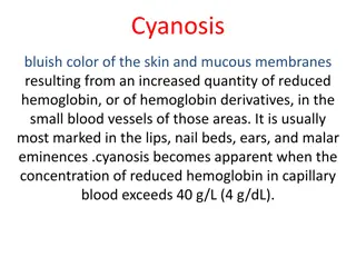 Cyanosis: Causes, Types, and Clinical Differentiation