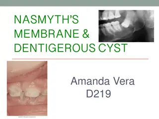 Nasmyth's Membrane and Dentigerous Cysts in Dental Health