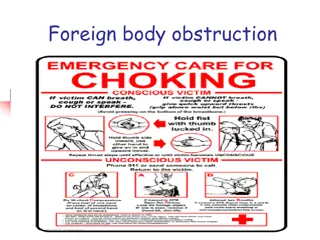 First Aid for Foreign Body Obstruction: Causes, Signs, and Management