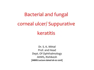 Overview of Bacterial and Fungal Corneal Ulcer