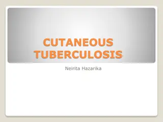 Overview of Cutaneous Tuberculosis: Causes, Classification, and Clinical Features