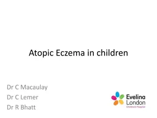 Atopic Eczema in Children and Its Management