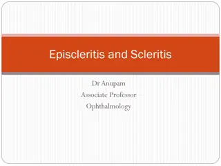 Understanding Episcleritis and Scleritis in Ophthalmology