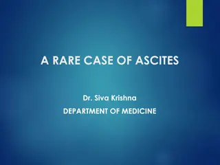 A Rare Case of Ascites in a 22-Year-Old Female: Clinical Presentation and Investigations