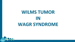 Wilms Tumor in WAGR Syndrome