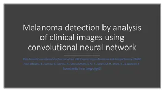 Automated Melanoma Detection Using Convolutional Neural Network