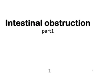 Intestinal Obstruction: Causes, Classification, and Pathophysiology