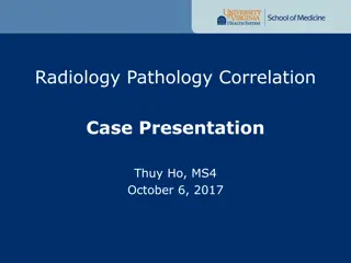 Radiology-Pathology Correlation Case Presentation: Ms. DR - Lung Mass Evaluation