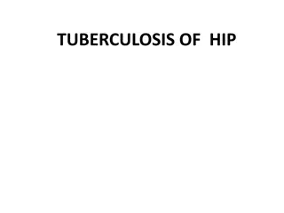 Tuberculosis of Hip and Knee Joint Deformities