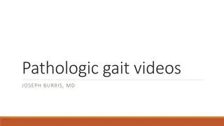 Overview of Pathologic Gait Patterns for Clinical Reference