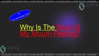 Roof of mouth peeling - Surya Dental PPT